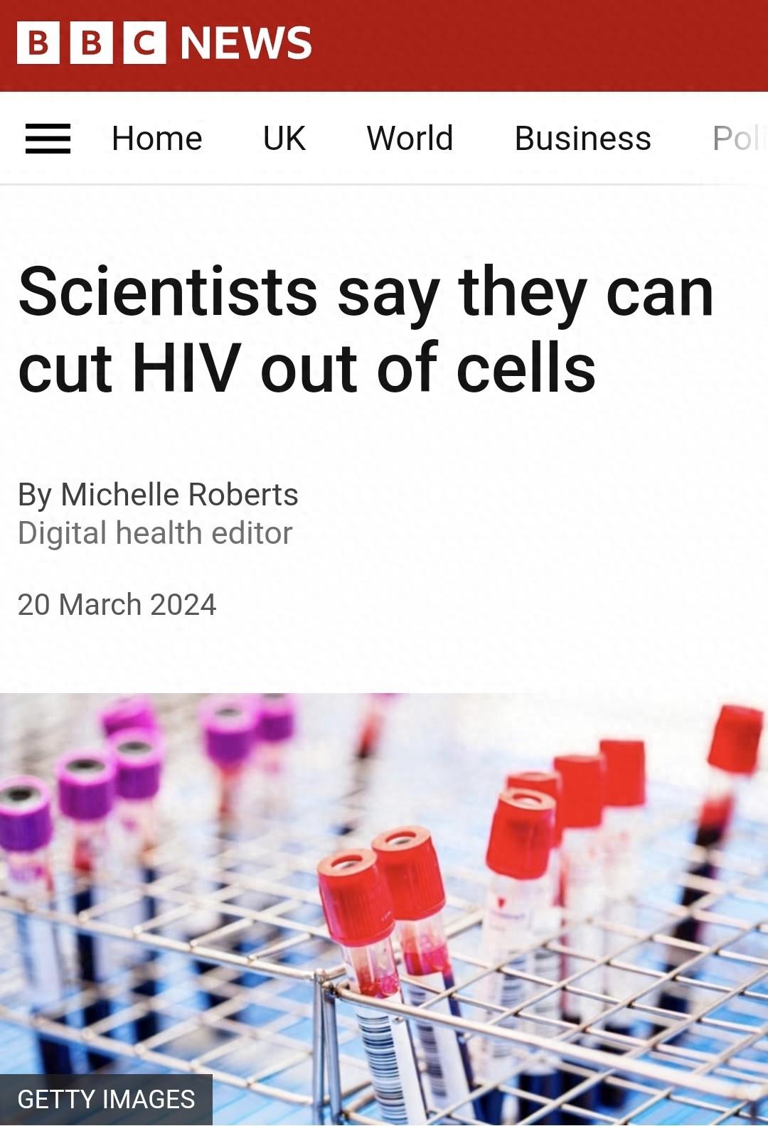 科学家成功清除已感染的hiv病毒